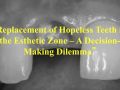Online Continuum (Curriculum Series) - Implant Success Criteria - Patient Evaluation for Dental Implants – Replacement of Hopeless Teeth in the Esthetic Zone