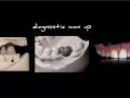 Online Continuum (Curriculum Series) - Prosthodontically Driven Treatment - Preliminary Restorative Plan Part 2