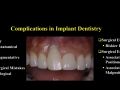 Continuum (Curriculum Series) - Surgical Implant Complications